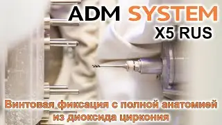 Фрезеровка винтовой фиксации с полной анатомией на станке ADM SYSTEM X5 RUS. Российский CAD/CAM