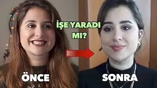 YANAK, BOYUN, GIDI ZAYIFLATMA EGZERSİZLERİ İŞE YARADI MI? 3 sene sonra...