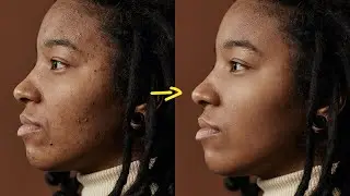 How to Quickly REMOVE PIMPLES & Blemishes in Photoshop | Photo Editing Tutorial