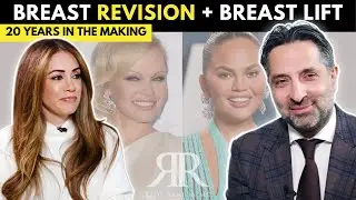 Why I Downsized My Breasts After 20 Yrs! [Breast Lift + Revision] #revision #beforeandafter