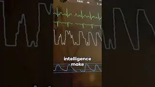 Innovating Healthcare : Contactless Vital Sign Monitoring #futuretech #innovation #ytshorts #viral