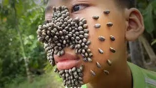 A strange tick on the face of a sad boy #039