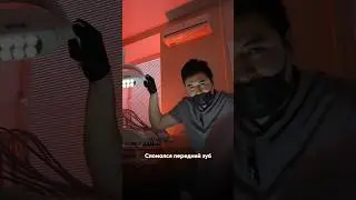 Приговор: сломанный передний зуб! Как исправить быстро?