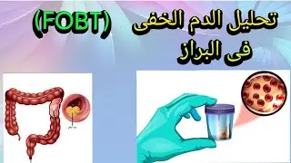 ما هو تحليل الدم الخفى فى البراز ؟Fecal occult blood test #تحاليل_طبية #FOBT
