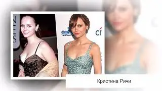 Знаменитости, уменьшившие грудь