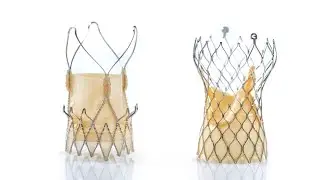 Transcatheter Mitral Valve Replacement: Valve-in-Valve, Valve-in-Ring, and Valve-in-MAC