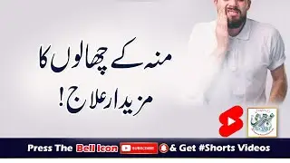 Moun Ke Chalon Ka Mazedar Ilaj