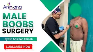 Gynecomastia Surgery Procedure Explained by Dr. Anirban Ghosh #plasticsurgeon #cosmeticsurgery