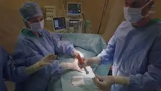 LIPO-STEM DUO™ in action: witness a live surgery with Dr. Mario Cecchetti.
