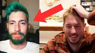 Reacting To My Most Cringe Pictures