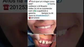 Harmonizaçåo dental