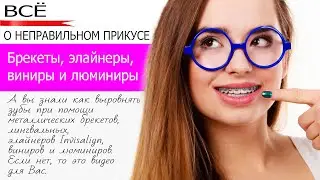 Как выровнять зубы? Брекеты, элайнеры, виниры и люминиры
