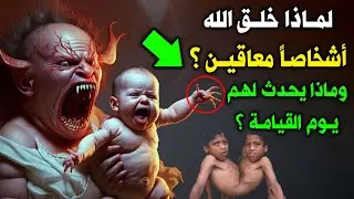 لماذا خلق الله أشخاصاً معاقين ؟ وماذا يحدث لهم يوم القيامة ؟ ولماذا سيحاسبهم الله بنفسه ؟ ستنصدم