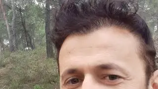 Sac ekimi den sonraki 4 cu gün