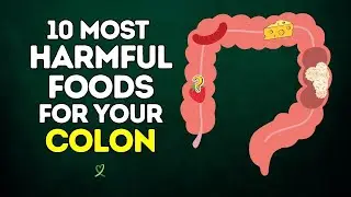 10 Most Harmful Foods For Your Colon
