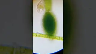 Alga dan Zooplankton (Perbesaran 400x)