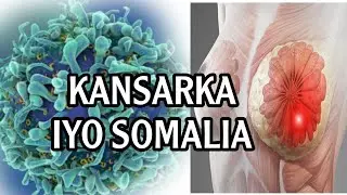 somalia kansarka ayaa si xowli ah usoo Badanaya || Dr.abshir Baando @xogocaafimaad