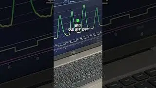 30초 안에 보는 회전형 중입자치료기 치료 과정