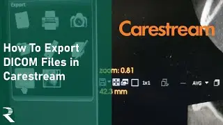 Carestream - How to export DICOM files