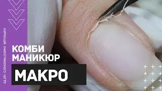 МАКРО комби маникюр 🔍Коррекция КЛЮЮЩЕГО ногтя акригелем 💅 Геометрический маникюр 2020