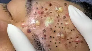 𝐄𝐧𝐣𝐨𝐲 𝐭𝐡𝐞 𝐬𝐮𝐫𝐩𝐫𝐢𝐬𝐞 𝐟𝐫𝐨𝐦 𝐋𝐨𝐚𝐧𝐍𝐠𝐮𝐲𝐞𝐧 #56182665
