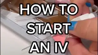 How to start an IV