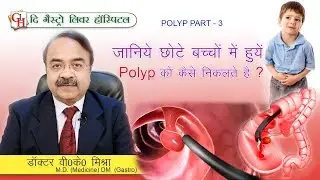 जानिये छोटे बच्चों में हुये polyp को कैसे निकलते है ? ||  Polyp part -3 || The Gastro Liver Hospital