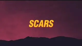 Keenan Te - Scars (Lyrics)