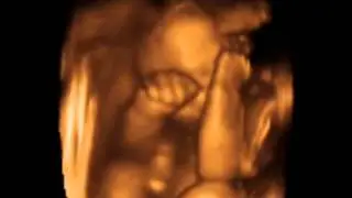 3D 4D Ultrasound Scan Baby #2