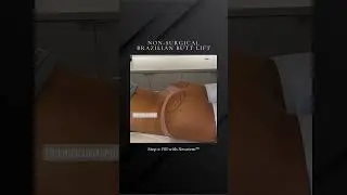 Non-Surgical Brazilian Butt Lift