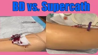 Comparing the BD Autoguard and the Supercath 5 IV catheter