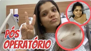 TUDO SOBRE UM PÓS OPERATÓRIO DE SEPTOPLASTIA E TURBINECTOMIA!!! + tirando os splints nasais.