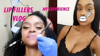 Lip Fillers Vlog | Getting Lip Fillers for the First Time!!