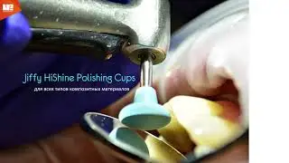 Jiffy HiShinePolish Cups