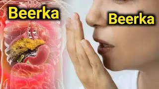 Caafimaadka Beerka /// maxoo u baahanyahay beerkaada si aad u ilaaliso caafimaadkiisa 😞 ⁉️