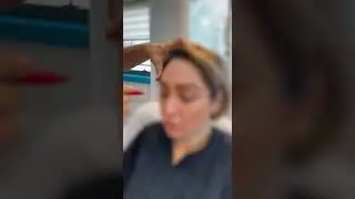 Botox Consultation Session With Dr.Abbas Ashrafzadeh #botox #botoxdubai #botoxinjections