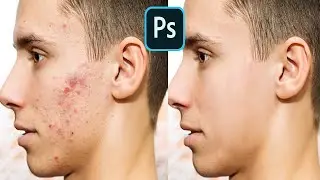 Photoshop Pimple Clean Tutorial Simple & Easy Way | Photoshop Pimple Clean and Smooth Skin