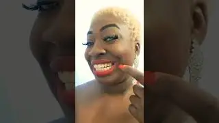 Removable Veneers USA, Best Clip On Veneers Review, Another Happy Client, #1 Snap On Veneers