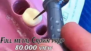 lower 6 full metal crown preparation شرح بالعربي