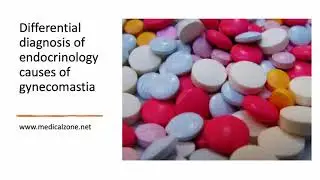 Medical Zone- Differential diagnosis of endocrinology causes of gynecomastia