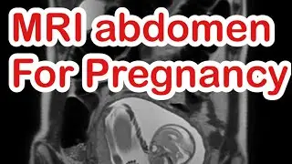 MRI Lower abdomen for patient more then first Trimester