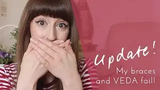 The Braces Are On (and VEDA fail!)
