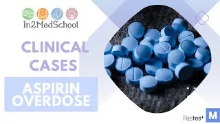 Aspirin overdose Clinical Case