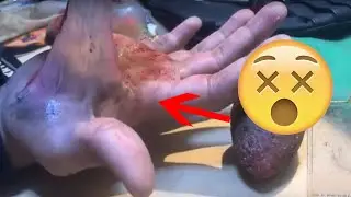 كيفية عمل حروق سينمائية - Makeup burns