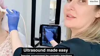 Training: Ultrasound made easy for cosmetic injections - planning, anatomy assessment. Temple filler