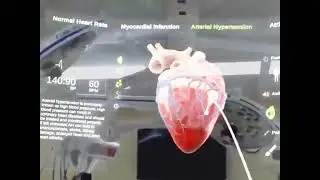 What does a beating heart look like? What about with a myocardial infarction? Arterial hypertension?