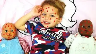 DOCTOR Emily treats pupsies ALEX caring like dad We play doctor Video for children Chickenpox