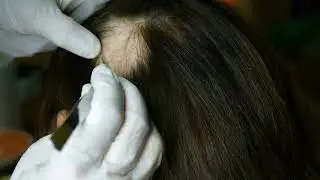 doctor or cosmetologist does inspection makes pro 2022 08 04 15 12 55 utc