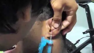 Draining A Cauliflower Ear: Brazilian Style In Brazil MMA BJJ - Mike Swick