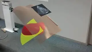 3D Body Mark of Echography with Augmented Reality Technology